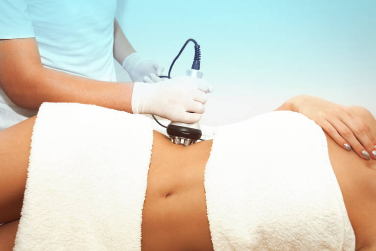 Ultrasound Cavitation